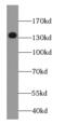 Diacylglycerol Kinase Kappa antibody, FNab02360, FineTest, Western Blot image 
