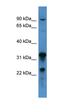 Cholinergic Receptor Nicotinic Beta 2 Subunit antibody, orb331572, Biorbyt, Western Blot image 