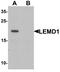LEM Domain Containing 1 antibody, PA5-72733, Invitrogen Antibodies, Western Blot image 