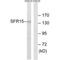 SR-Related CTD Associated Factor 4 antibody, PA5-50143, Invitrogen Antibodies, Western Blot image 