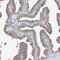 WD Repeat Domain 77 antibody, HPA026448, Atlas Antibodies, Immunohistochemistry paraffin image 