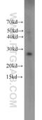 15-PGDH antibody, 11035-1-AP, Proteintech Group, Western Blot image 