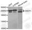 CCR4-NOT Transcription Complex Subunit 1 antibody, A5969, ABclonal Technology, Western Blot image 