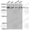 Phospholipase C Gamma 2 antibody, A2182, ABclonal Technology, Western Blot image 