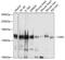 Valyl-TRNA Synthetase antibody, 19-302, ProSci, Western Blot image 