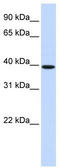 Homeobox protein Hox-B3 antibody, TA344487, Origene, Western Blot image 