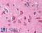 Ring Finger Protein 34 antibody, LS-B132, Lifespan Biosciences, Immunohistochemistry paraffin image 