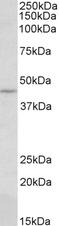 HIC ZBTB Transcriptional Repressor 1 antibody, 43-339, ProSci, Enzyme Linked Immunosorbent Assay image 