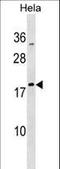 Mitochondrial Ribosomal Protein L48 antibody, LS-C158304, Lifespan Biosciences, Western Blot image 