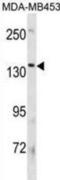 ATPase Phospholipid Transporting 8B3 antibody, abx031443, Abbexa, Western Blot image 