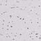 Zinc Finger Protein 860 antibody, PA5-64113, Invitrogen Antibodies, Immunohistochemistry frozen image 