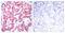 GATA Binding Protein 1 antibody, PA5-37581, Invitrogen Antibodies, Immunohistochemistry paraffin image 