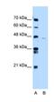 Ankyrin Repeat Domain 65 antibody, orb325367, Biorbyt, Western Blot image 