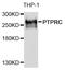 Lca antibody, TA327279, Origene, Western Blot image 