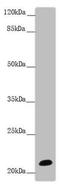 Neurocalcin Delta antibody, LS-C676124, Lifespan Biosciences, Western Blot image 