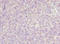 Tumor Protein P53 Regulated Apoptosis Inducing Protein 1 antibody, orb40208, Biorbyt, Immunohistochemistry paraffin image 
