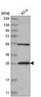 hMed6 antibody, NBP2-55253, Novus Biologicals, Western Blot image 