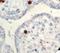 Parvovirus antibody, LS-C312135, Lifespan Biosciences, Immunohistochemistry frozen image 