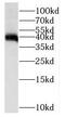 Protein Tyrosine Phosphatase Non-Receptor Type 7 antibody, FNab06940, FineTest, Western Blot image 