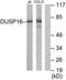Dual specificity protein phosphatase 16 antibody, TA326266, Origene, Western Blot image 