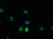 Cytoplasmic polyadenylation element-binding protein 2 antibody, orb51758, Biorbyt, Immunocytochemistry image 