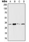 Homeobox protein SIX3 antibody, orb214575, Biorbyt, Western Blot image 