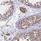 Translocase Of Inner Mitochondrial Membrane 44 antibody, HPA043052, Atlas Antibodies, Immunohistochemistry paraffin image 