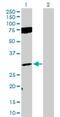 Fibroblast Growth Factor 12 antibody, H00002257-D01P, Novus Biologicals, Western Blot image 