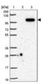 DnaJ Heat Shock Protein Family (Hsp40) Member C16 antibody, PA5-60449, Invitrogen Antibodies, Western Blot image 