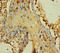 PTPN13 Like Y-Linked 2 antibody, A63238-100, Epigentek, Immunohistochemistry paraffin image 