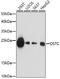 Oligosaccharyltransferase complex subunit OSTC antibody, 16-883, ProSci, Western Blot image 