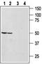 Neuromedin B Receptor antibody, TA328625, Origene, Western Blot image 