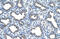 Ubiquitin Conjugating Enzyme E2 D2 antibody, ARP43008_T100, Aviva Systems Biology, Immunohistochemistry paraffin image 