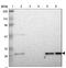 Casein kinase II subunit beta antibody, NBP1-87483, Novus Biologicals, Western Blot image 