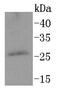 Protein Phosphatase 1 Regulatory Inhibitor Subunit 1A antibody, NBP2-67695, Novus Biologicals, Western Blot image 