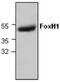 Forkhead Box H1 antibody, GTX59741, GeneTex, Western Blot image 