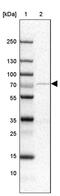 Alpha-1,3-Mannosyl-Glycoprotein 4-Beta-N-Acetylglucosaminyltransferase A antibody, PA5-52456, Invitrogen Antibodies, Western Blot image 