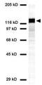 Desmoglein 3 antibody, GTX17502, GeneTex, Western Blot image 