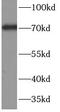 Complement C9 antibody, FNab10107, FineTest, Western Blot image 