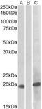 Homeobox protein Hox-A1 antibody, GTX88041, GeneTex, Western Blot image 