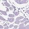 Periplakin antibody, HPA059859, Atlas Antibodies, Immunohistochemistry frozen image 