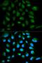 SH2 Domain Containing 1A antibody, orb135861, Biorbyt, Immunofluorescence image 