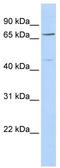 Kelch-like protein 15 antibody, TA344319, Origene, Western Blot image 