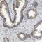 Mitochondrial fission 1 protein antibody, PA5-53605, Invitrogen Antibodies, Immunohistochemistry paraffin image 