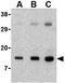 Phorbol-12-Myristate-13-Acetate-Induced Protein 1 antibody, GTX85521, GeneTex, Western Blot image 