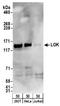 Serine/threonine-protein kinase 10 antibody, A300-399A, Bethyl Labs, Western Blot image 