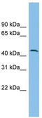 Diphthamide Biosynthesis 1 antibody, TA340016, Origene, Western Blot image 
