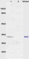 XIAP Associated Factor 1 antibody, GTX51339, GeneTex, Western Blot image 