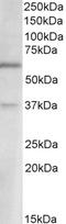 Solute Carrier Family 17 Member 6 antibody, LS-C205079, Lifespan Biosciences, Western Blot image 