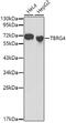Protein TBRG4 antibody, GTX55813, GeneTex, Western Blot image 
